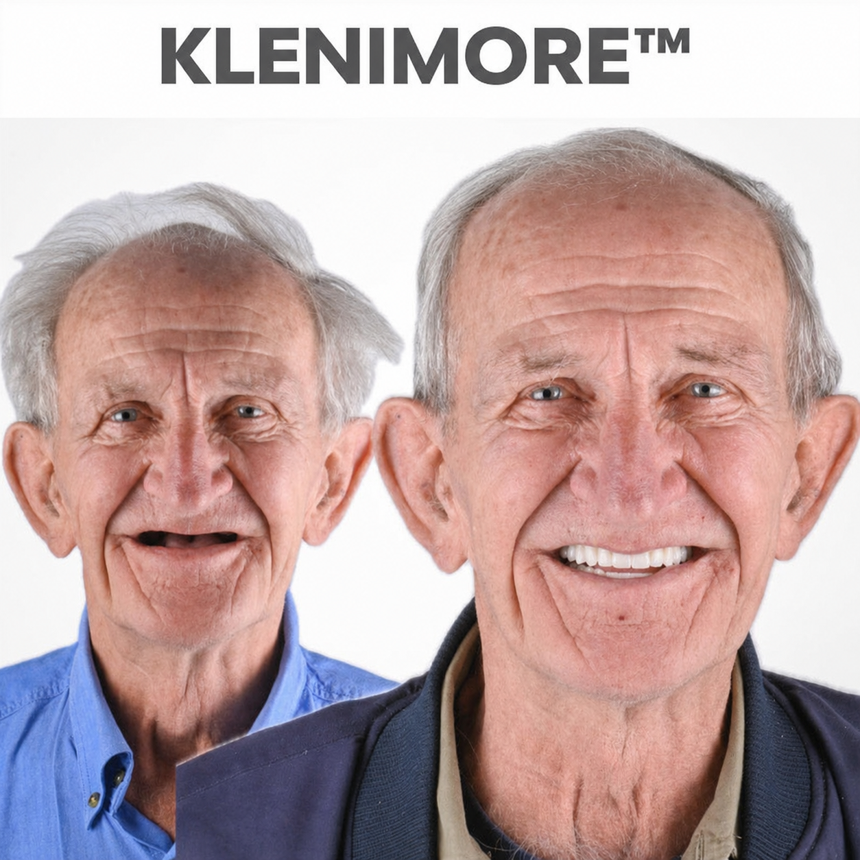⏰ Premium Custom Denture Set 🦷— Today's Special Offer | 😀Smile with Confidence|Buy 2 Get 1 Free
